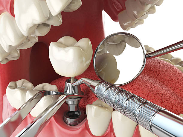 Best Emergency Cosmetic Dentistry in Kingston, OK